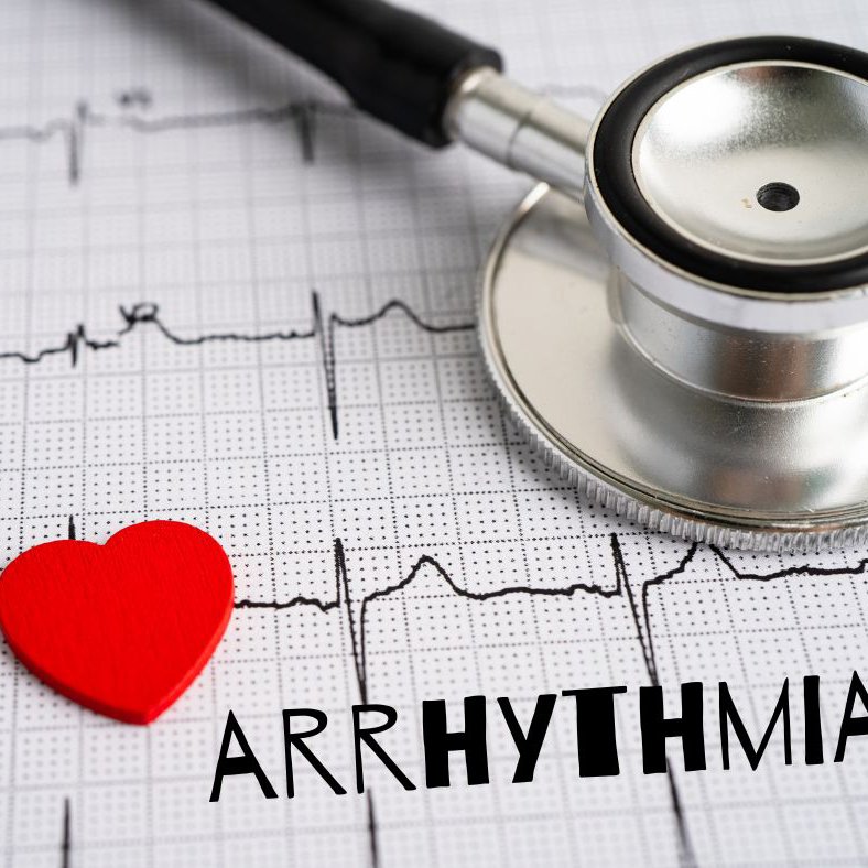 Arrhythmia episode artwork